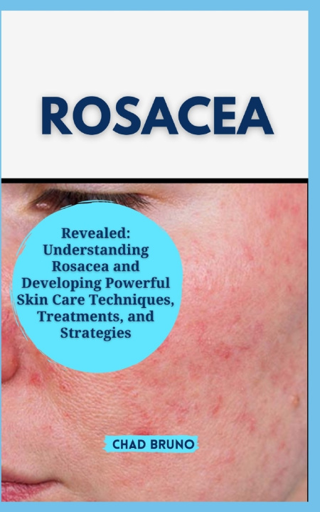 Kniha ROSACEA CHAD BRUNO