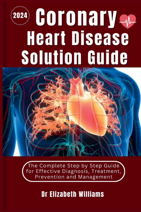 Kniha Coronary Heart Disease Solution Guide Dr Elizabeth Williams