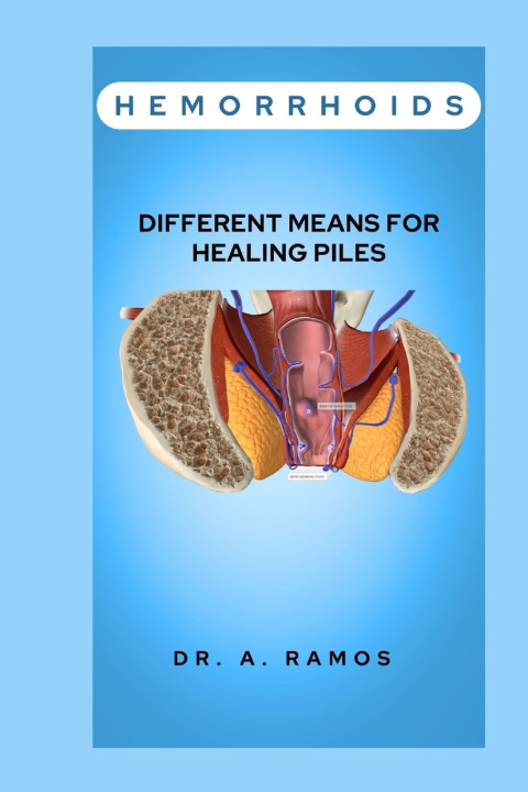 Kniha HEMORRHOIDS DR. A. RAMOS