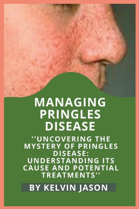 Knjiga MANAGING PRINGLES DISEASE Kelvin Jason