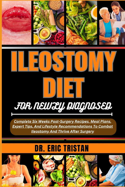 Książka ILEOSTOMY DIET FOR NEWLY DIAGNOSED DR. ERIC TRISTAN