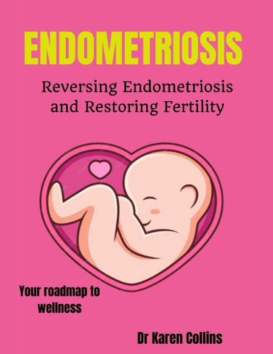 Książka ENDOMETRIOSIS Karen Collins
