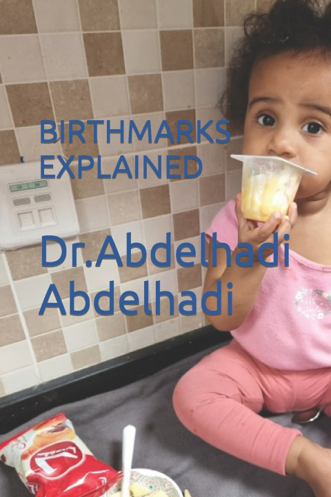 Kniha BIRTHMARKS EXPLAINED Abdelhadi Abdelgabbar Abdelhadi