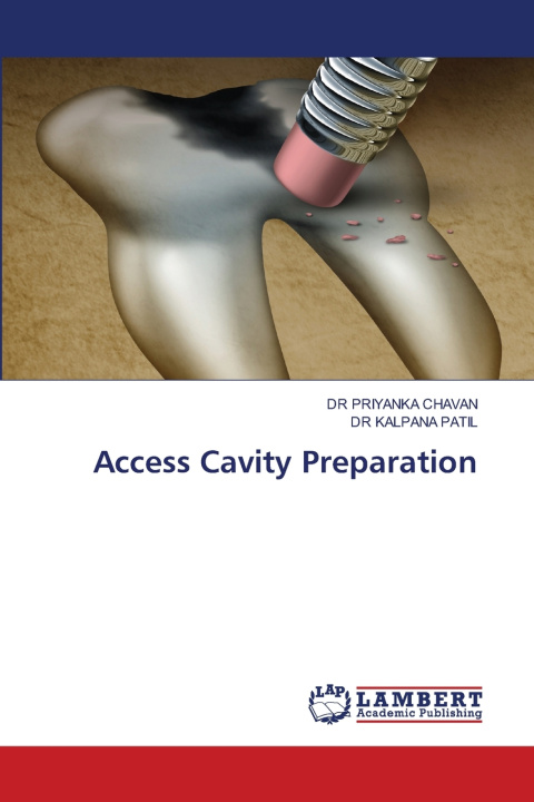 Kniha Access Cavity Preparation DR PRIYANKA CHAVAN
