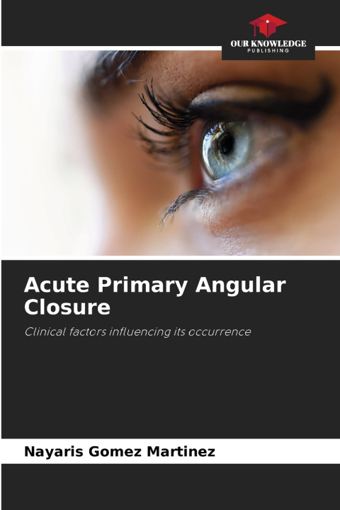 Knjiga Acute Primary Angular Closure Nayaris Gomez Martinez