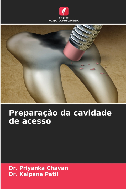 Kniha Preparação da cavidade de acesso Dr. Priyanka Chavan