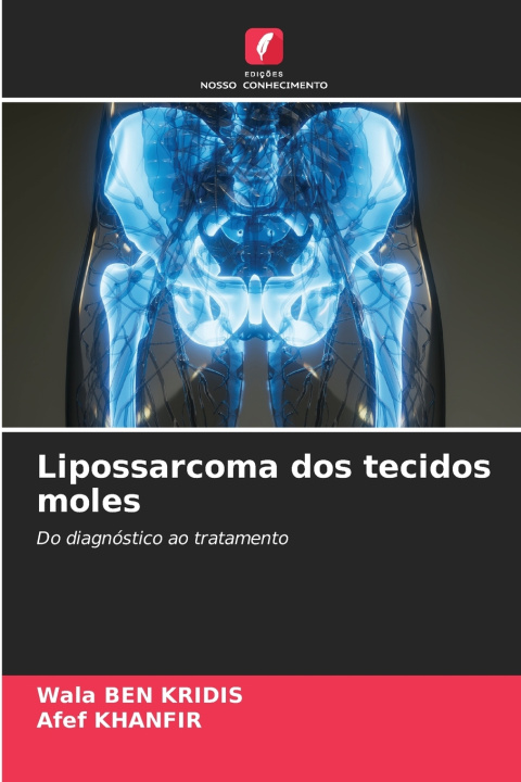 Kniha Lipossarcoma dos tecidos moles Wala BEN KRIDIS