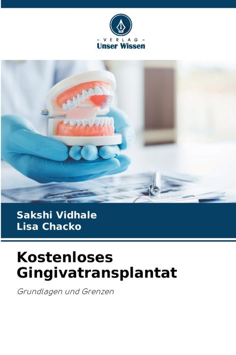 Knjiga Kostenloses Gingivatransplantat Lisa Chacko