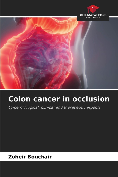 Knjiga Colon cancer in occlusion Zoheir Bouchair