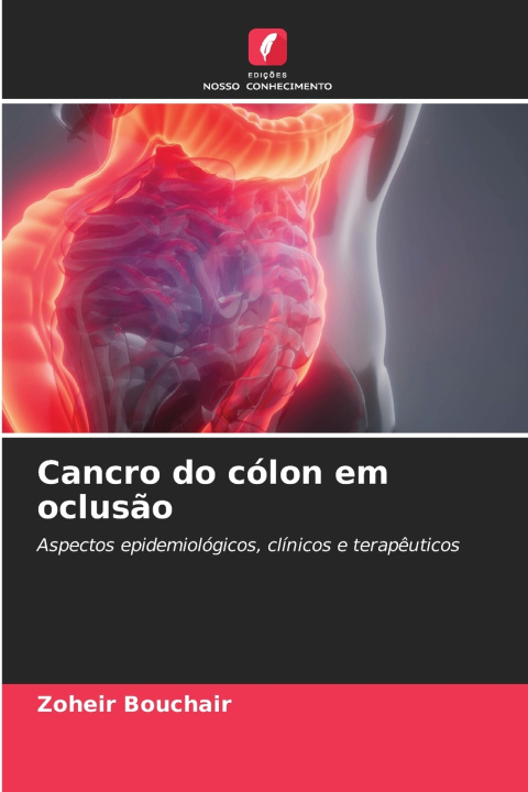 Kniha Cancro do cólon em oclusão Zoheir Bouchair