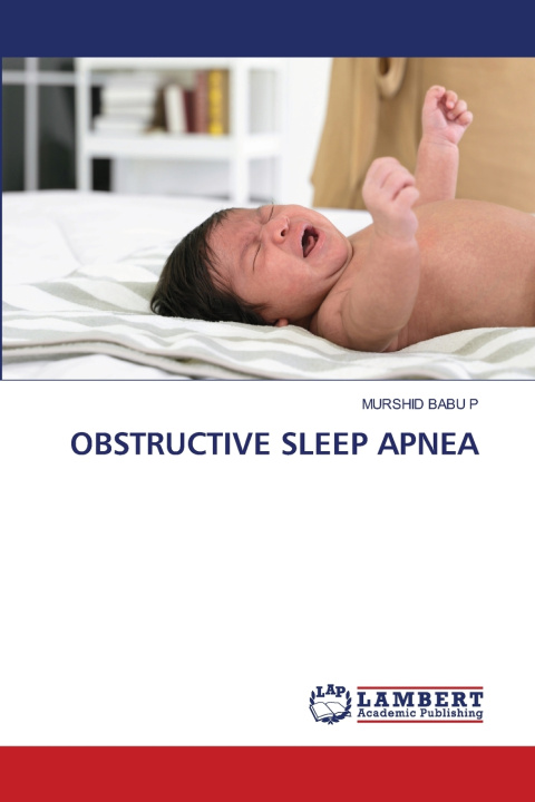 Kniha OBSTRUCTIVE SLEEP APNEA MURSHID BABU P