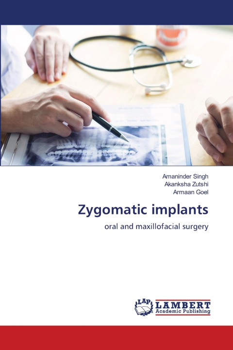 Kniha Zygomatic implants Akanksha Zutshi