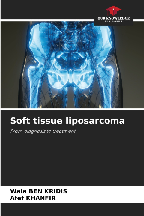 Kniha Soft tissue liposarcoma Wala BEN KRIDIS