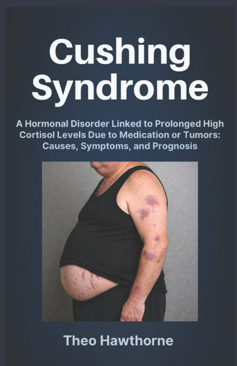 Kniha Cushing Syndrome Theo Hawthorne