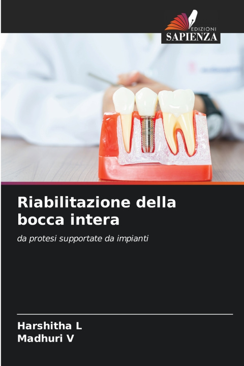 Kniha Riabilitazione della bocca intera Harshitha L