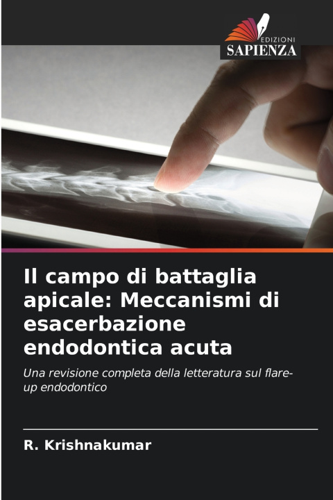Kniha Il campo di battaglia apicale: Meccanismi di esacerbazione endodontica acuta R. Krishnakumar