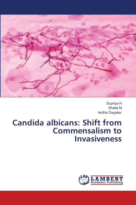 Kniha Candida albicans Supriya H
