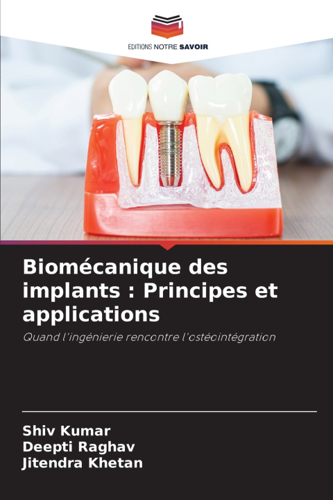 Kniha Biomécanique des implants SHIV KUMAR