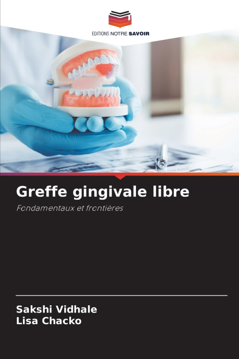 Knjiga Greffe gingivale libre Sakshi Vidhale