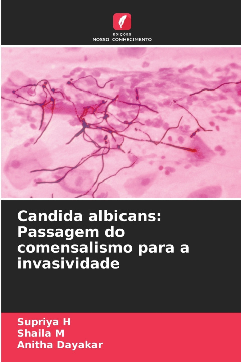 Książka Candida albicans Supriya H