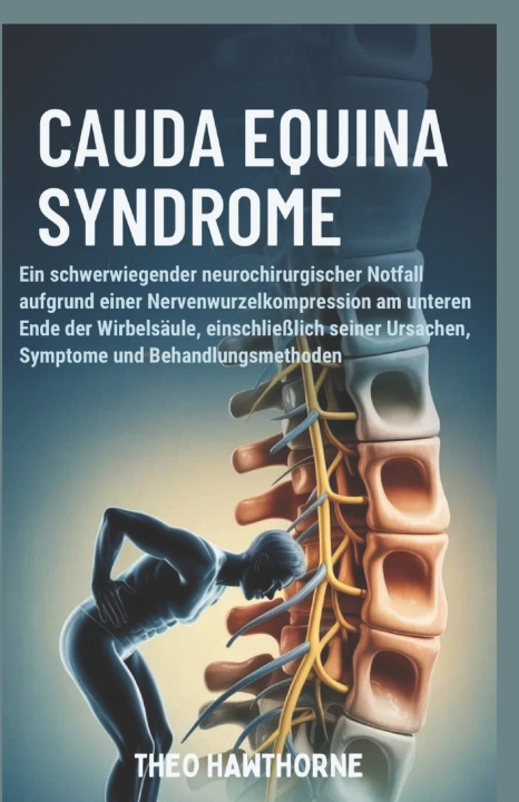 Boek Cauda Equina Syndrome Theo Hawthorne