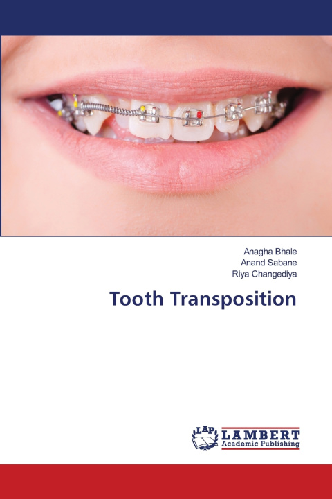 Kniha Tooth Transposition Anagha Bhale