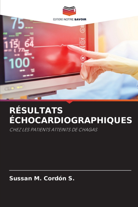 Könyv RÉSULTATS ÉCHOCARDIOGRAPHIQUES Sussan M. Cordón S.