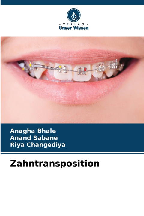 Kniha Zahntransposition Anagha Bhale