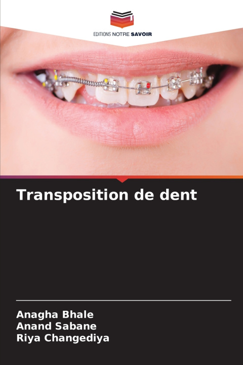 Knjiga Transposition de dent Anagha Bhale