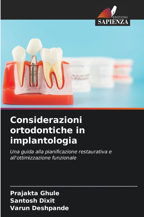 Kniha Considerazioni ortodontiche in implantologia Prajakta Ghule