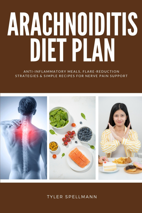 Könyv Arachnoiditis Diet Plan Tyler Spellmann