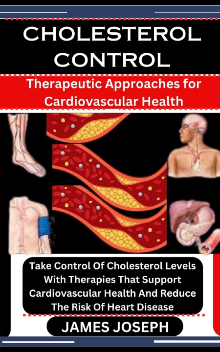 Knjiga CHOLESTEROL CONTROL JAMES JOSEPH