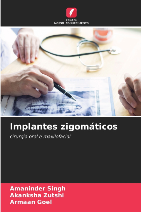 Knjiga Implantes zigomáticos Amaninder Singh