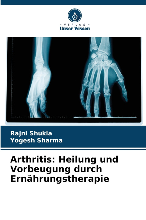 Knjiga Arthritis Rajni Shukla