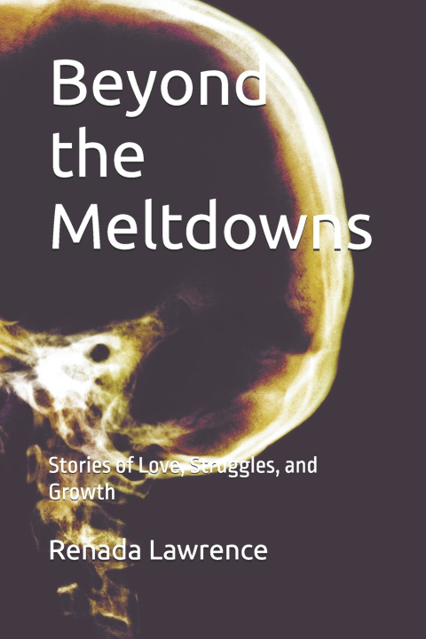 Kniha Beyond the Meltdowns Renada Lawrence
