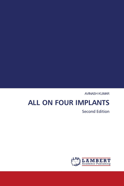 Kniha ALL ON FOUR IMPLANTS 