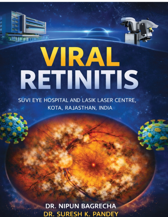 Knjiga VIRAL RETINITIS DR.NIPUN BAGRECHA