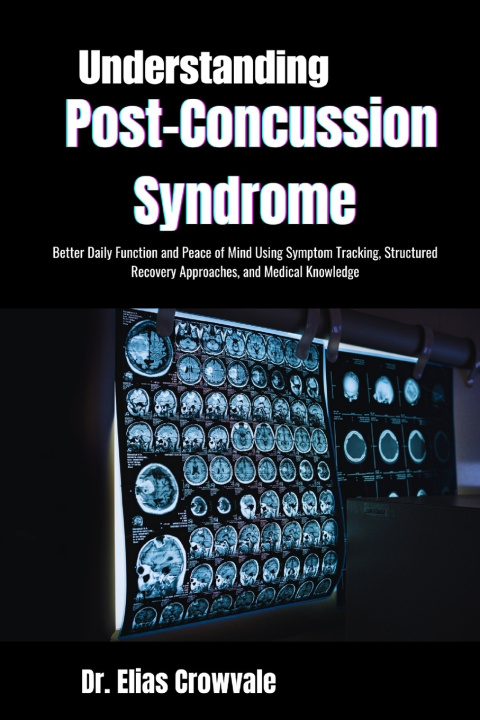 Kniha Understanding Post-Concussion Syndrome Dr. Elias Crowvale