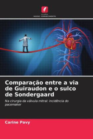 Kniha Comparação entre a via de Guiraudon e o sulco de Sondergaard Carine Pavy