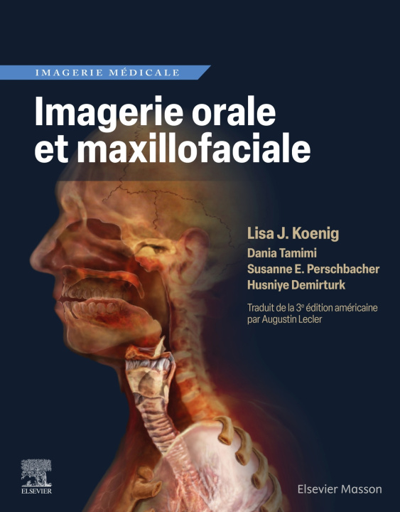 Knjiga Imagerie orale et maxillofaciale Lisa J. Koenig