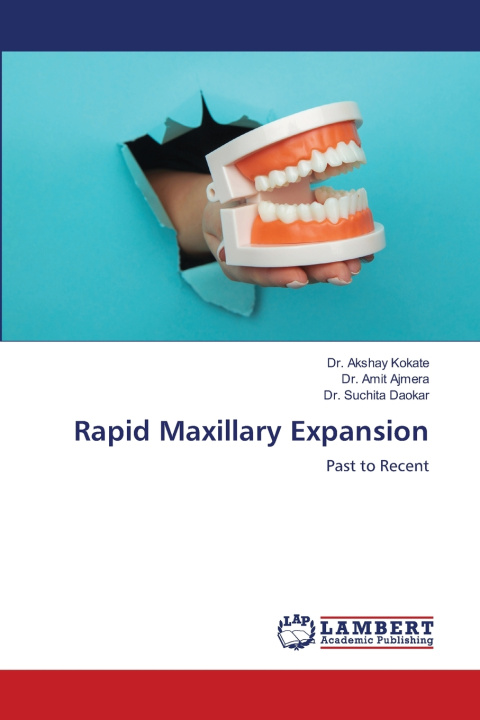 Kniha Rapid Maxillary Expansion Dr. Akshay Kokate