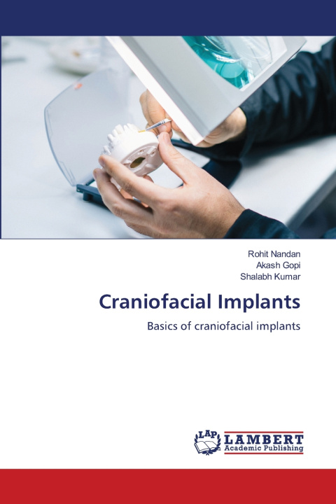 Kniha Craniofacial Implants Rohit Nandan