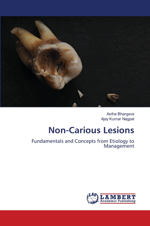 Knjiga Non-Carious Lesions Astha Bhargava