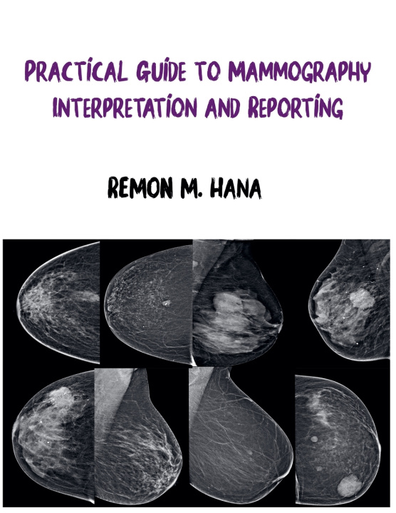 Книга Practical Guide to Mammography Interpretation and Reporting Remon M. Hana