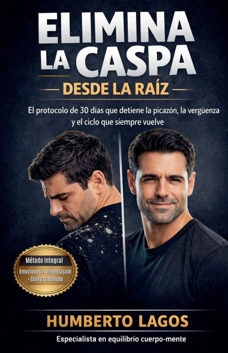 Buch Elimina La Caspa Desde La Raíz Humberto Lagos