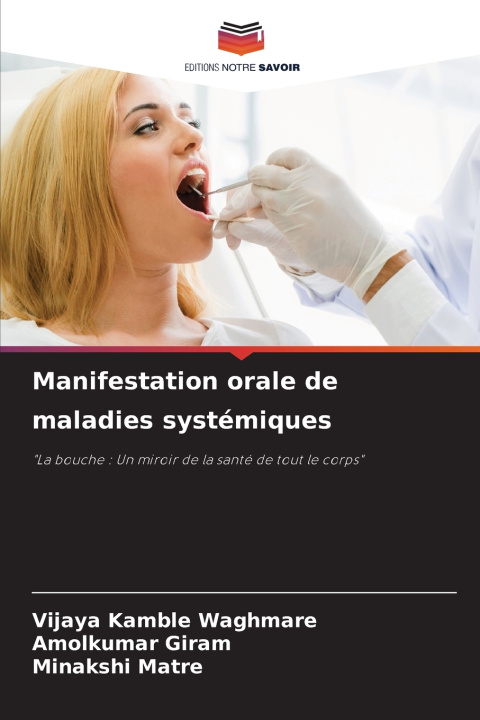 Książka Manifestation orale de maladies systémiques Vijaya Kamble Waghmare