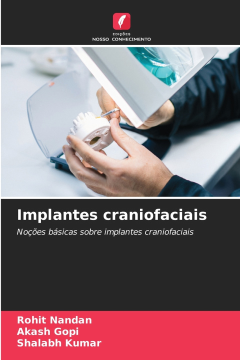Buch Implantes craniofaciais Rohit Nandan