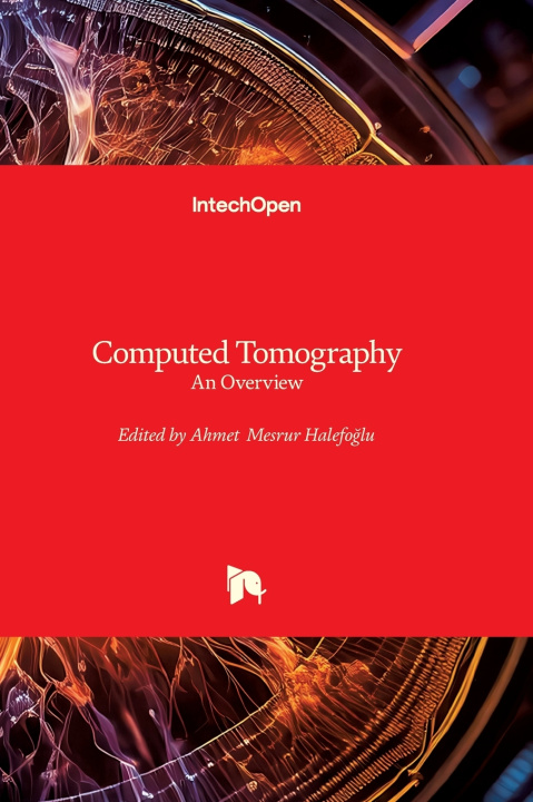 Buch Computed Tomography - An Overview Ahmet Mesrur Halefoğlu