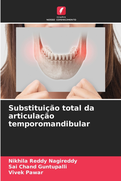 Kniha Substituição total da articulação temporomandibular Nikhila Reddy Nagireddy