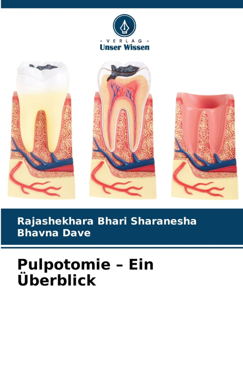 Kniha Pulpotomie - Ein Überblick Rajashekhara Bhari Sharanesha